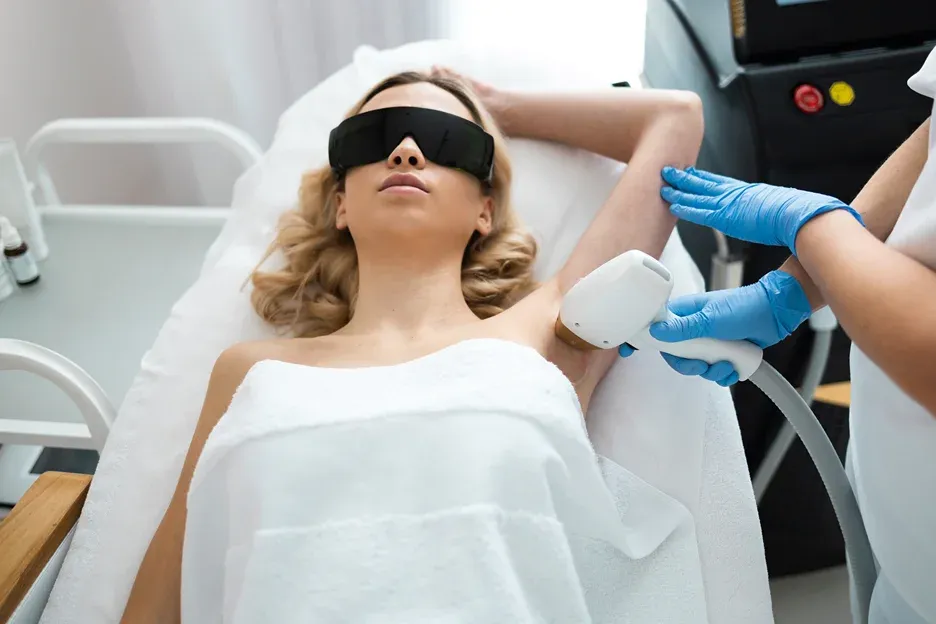 laser hair removal treatment