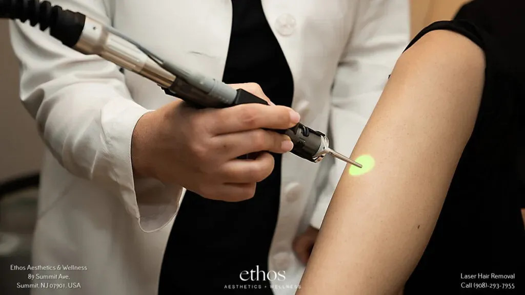 laser hair removal at Ethos Spa