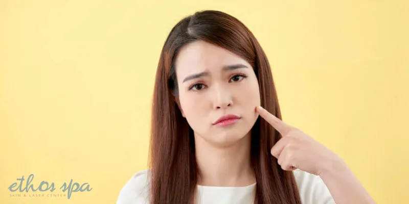 What Causes Chin Hair in Women?