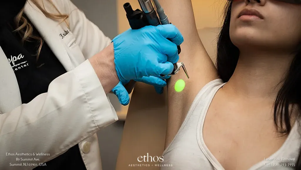 underarm laser hair removal treatment