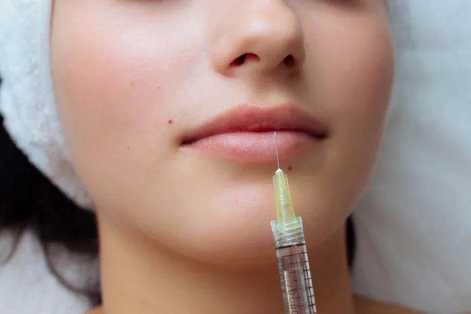 lip filler treatment