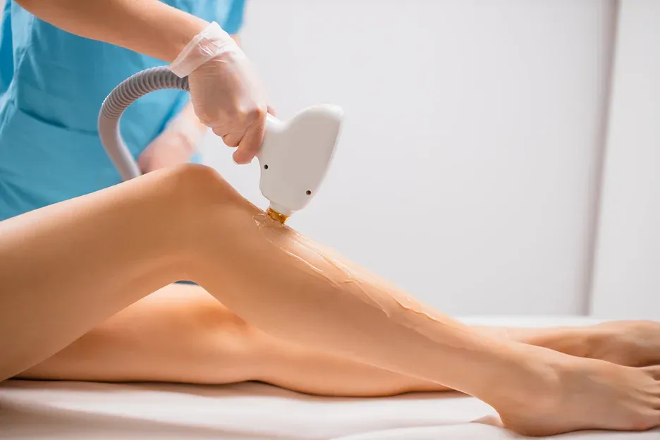 Laser Hair Removal Treatment