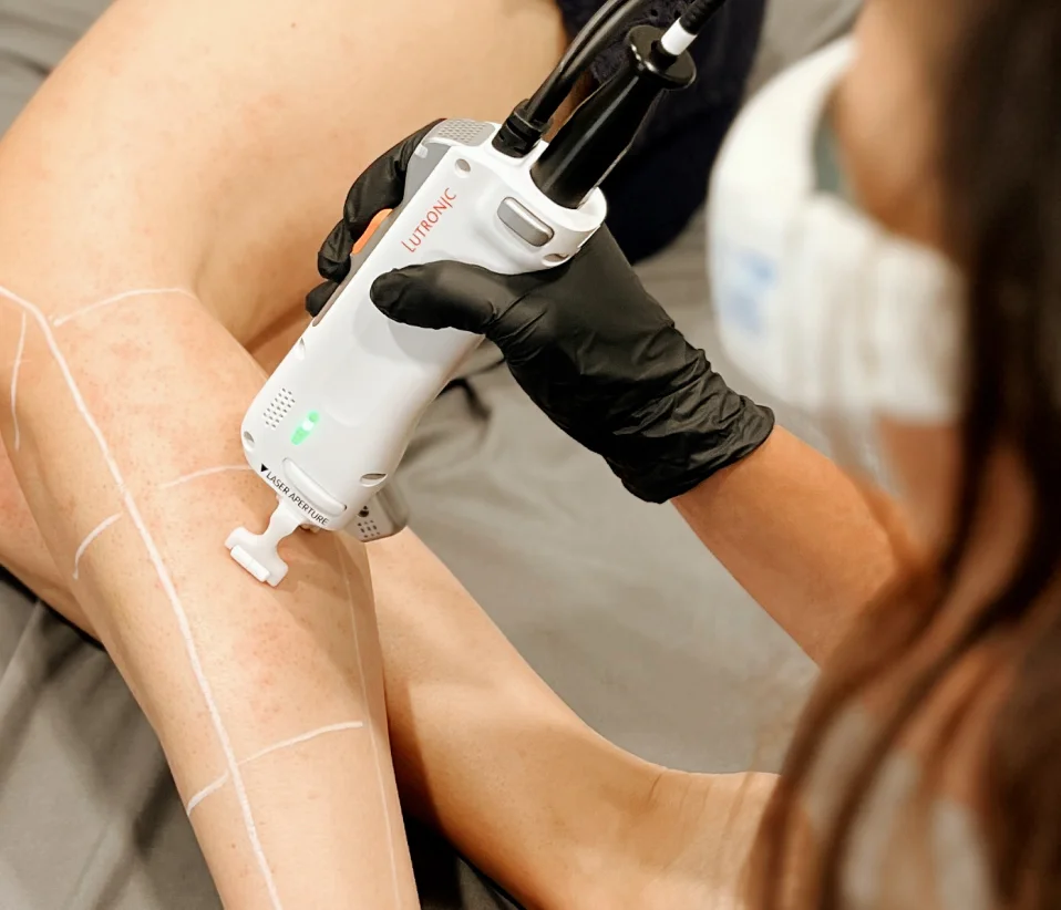 Smooth skin after laser hair removal