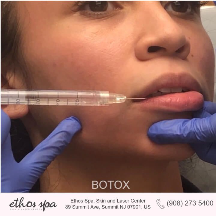 Woman getting lips injected with Botox