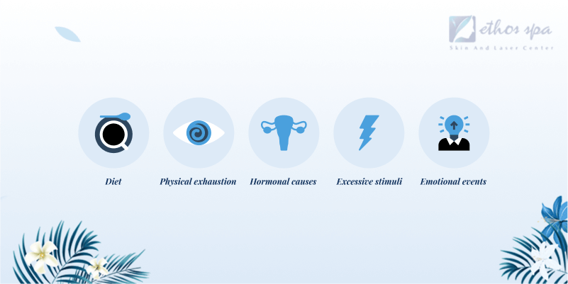 causes of migraine illustrated